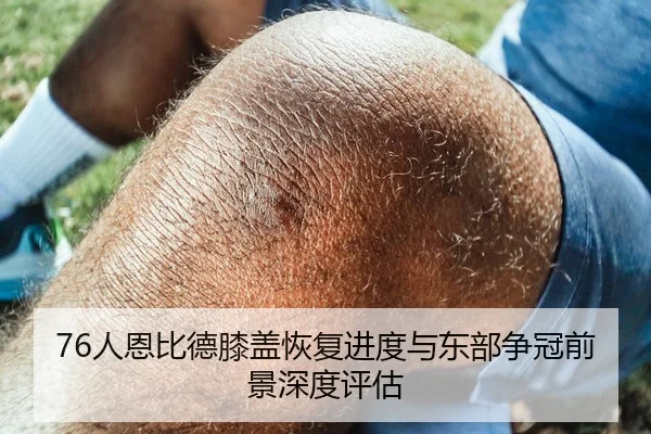 76人恩比德膝盖恢复进度与东部争冠前景深度评估